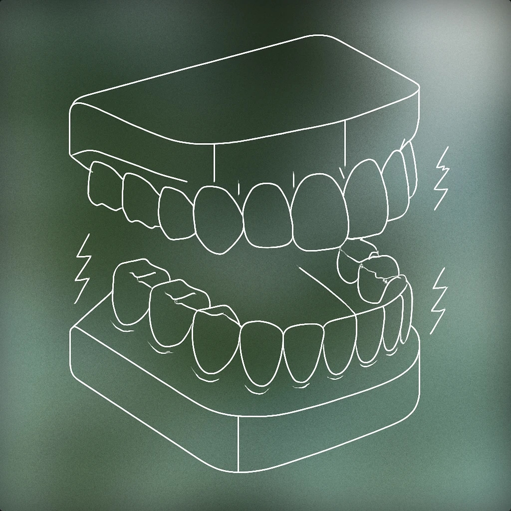 Cover of A pair of upper and lower human teeth slightly apart with subtle jagged lines between them to suggest vibration for Teeth Chattering sound effects